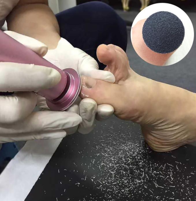 Electric foot grinder automatic foot repair artifact removing dead skin