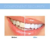 LED Teeth Whitening